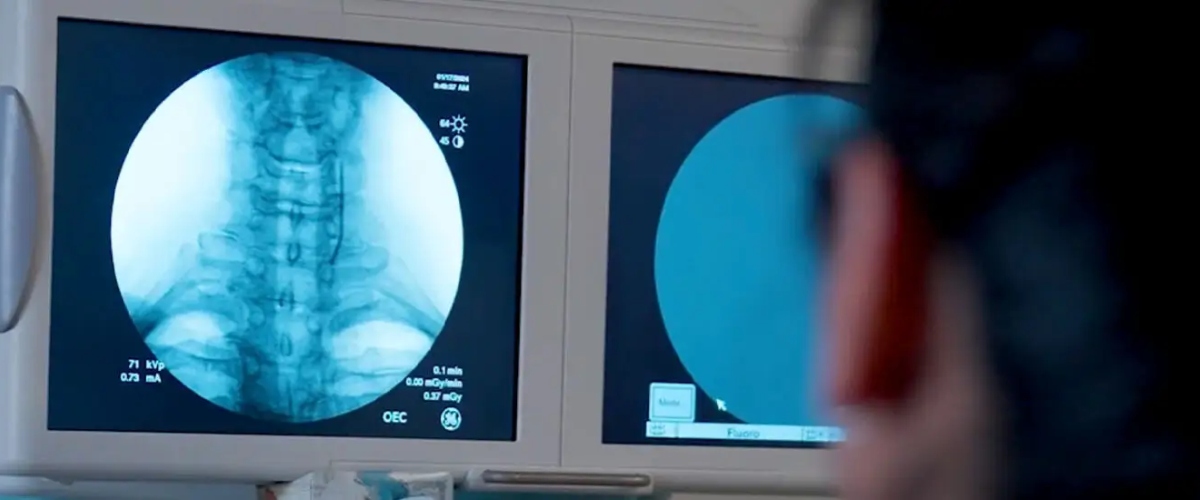 Fluoroscopically-Guided Joint Injections