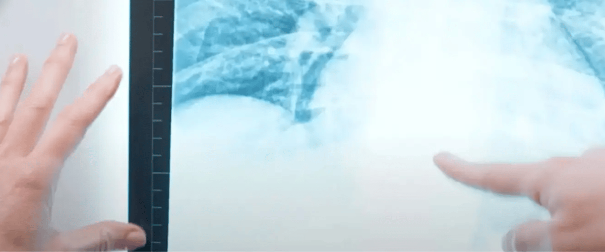 Doctor reviews spine X-ray for diagnosis at Desert Spine and Sports Physicians in Arizona.